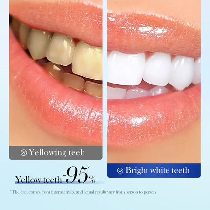 Niacinamide Toothpaste Whitening Teeth Remover Stain Cleans Teeth and Mouth Fresh Breath Toothpaste 220g