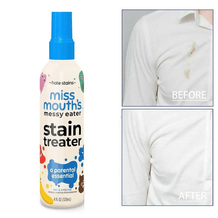 120/300ML Laundry Stain Remover Anti Germ & Deodorization For Clothes Fabric Upholstery Carpet Stain Spray Yellow Removal Bleach