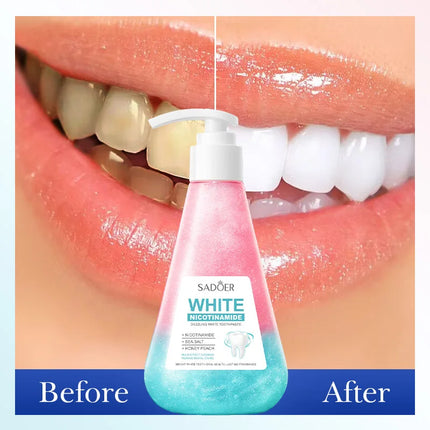 Niacinamide Toothpaste Whitening Teeth Remover Stain Cleans Teeth and Mouth Fresh Breath Toothpaste 220g